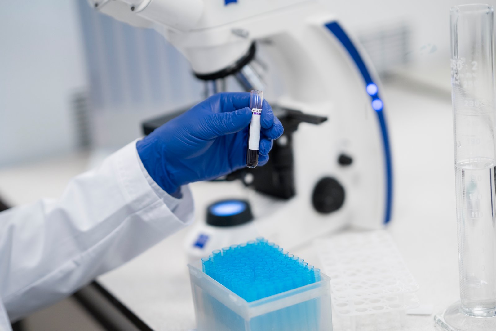 Pathology sample collection at AAS Lab Diagnostic Centre, Mian Channu